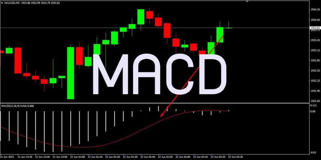 MACD